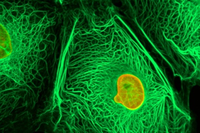 Tìm ra cơ chế làm tế bào ung thư 'tự chết'